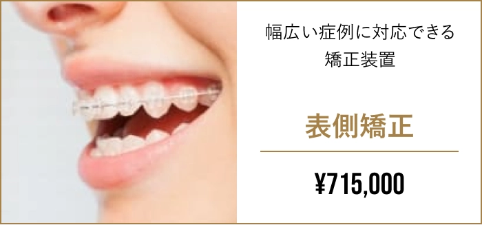 表側矯正