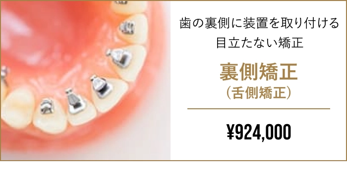 裏側矯正