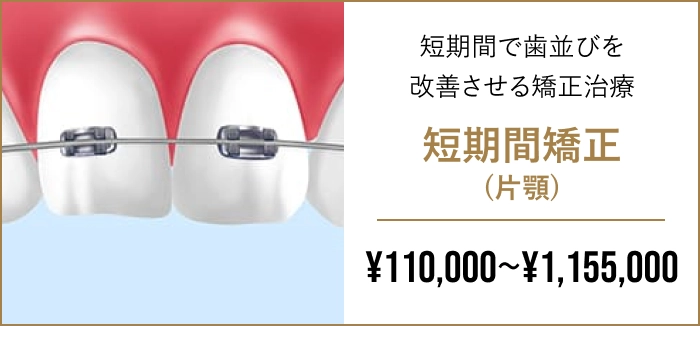 短期間矯正