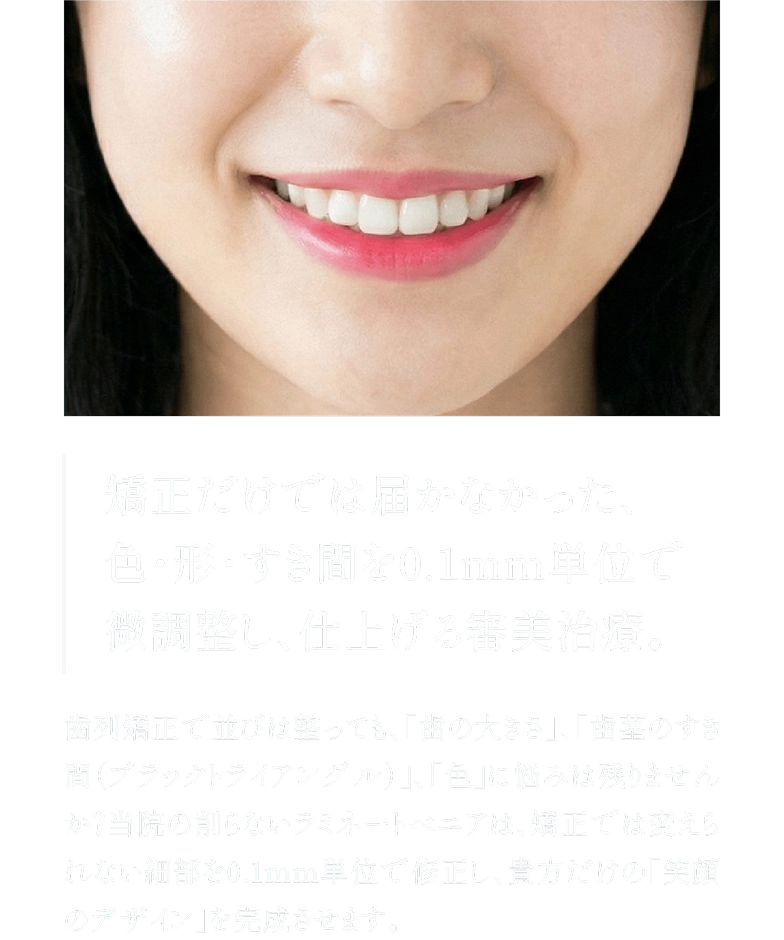 矯正だけでは届かなかった、色・形・すき間を0.1mm単位で微調整し、仕上げる審美治療。