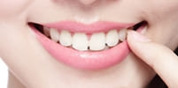 短期間で歯並びを改善させる矯正治療