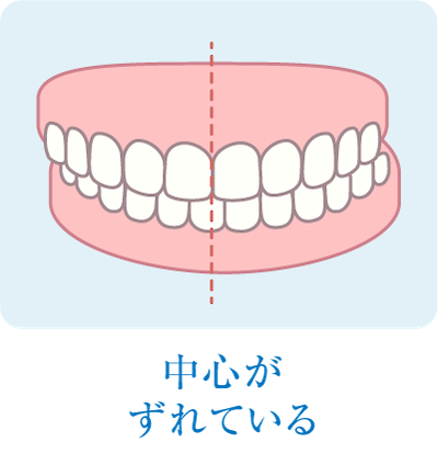 中心がずれている